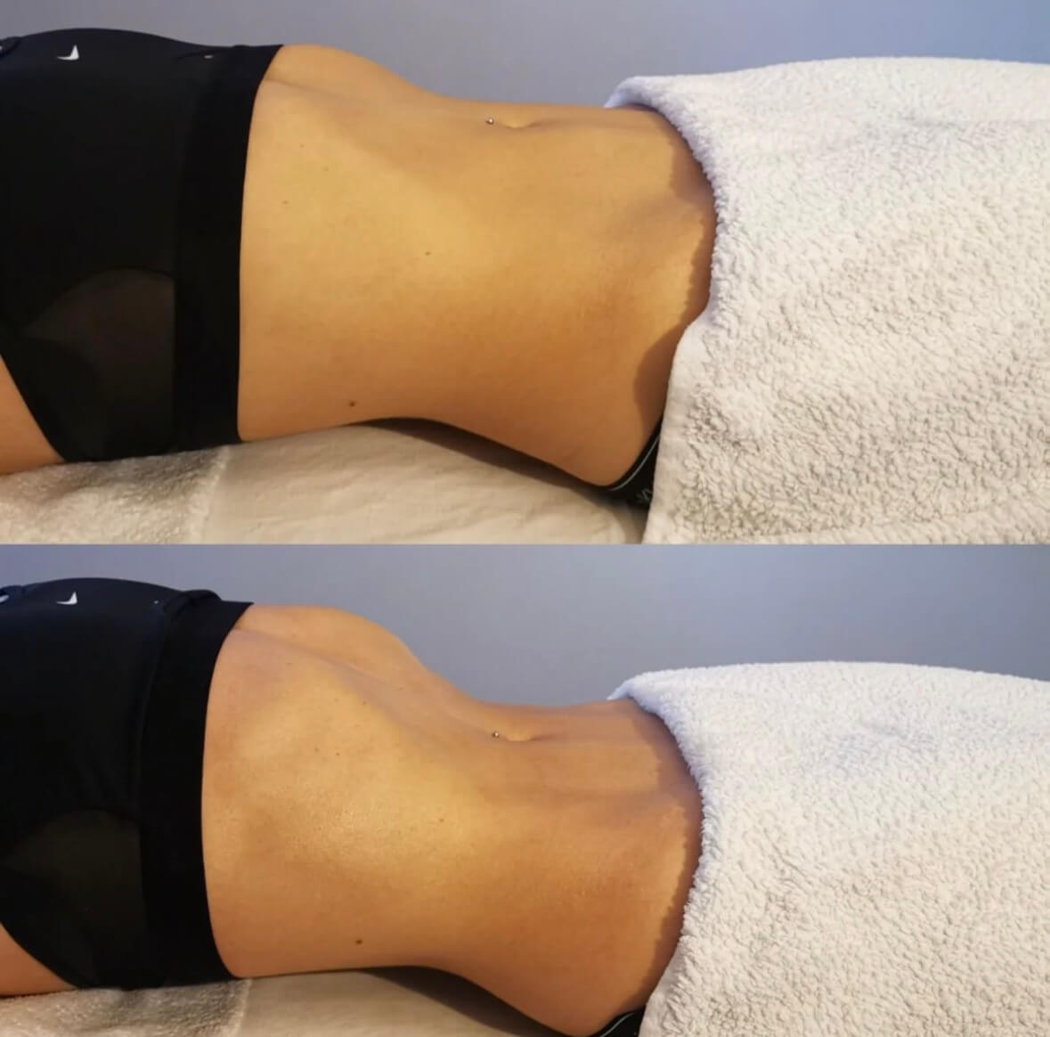 bienfaits du massage lymphatique